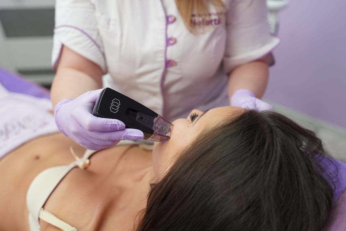 Процедура Morpheus8 срещу белези от акне в Beauty Studio Nefertiti, Бургас